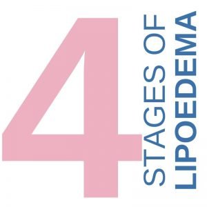 4 Stages of Lipoedema