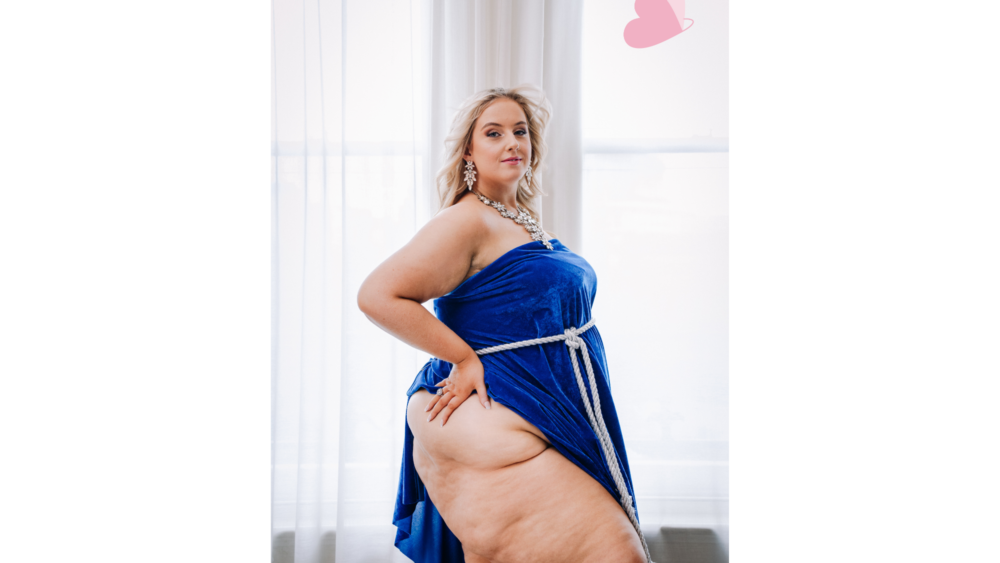 Roisin at our Lipoedema Awareness Photoshoot in April 2023