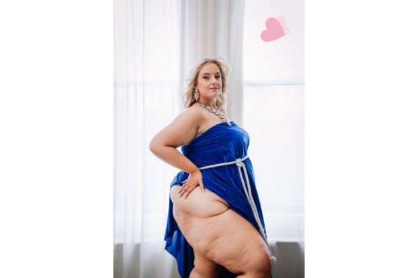 Roisin at our Lipoedema Awareness Photoshoot in April 2023