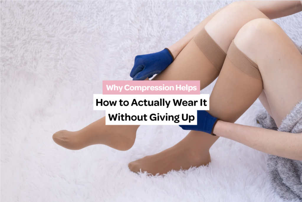 Applying compression stockings as part of lipoedema management and recovery care