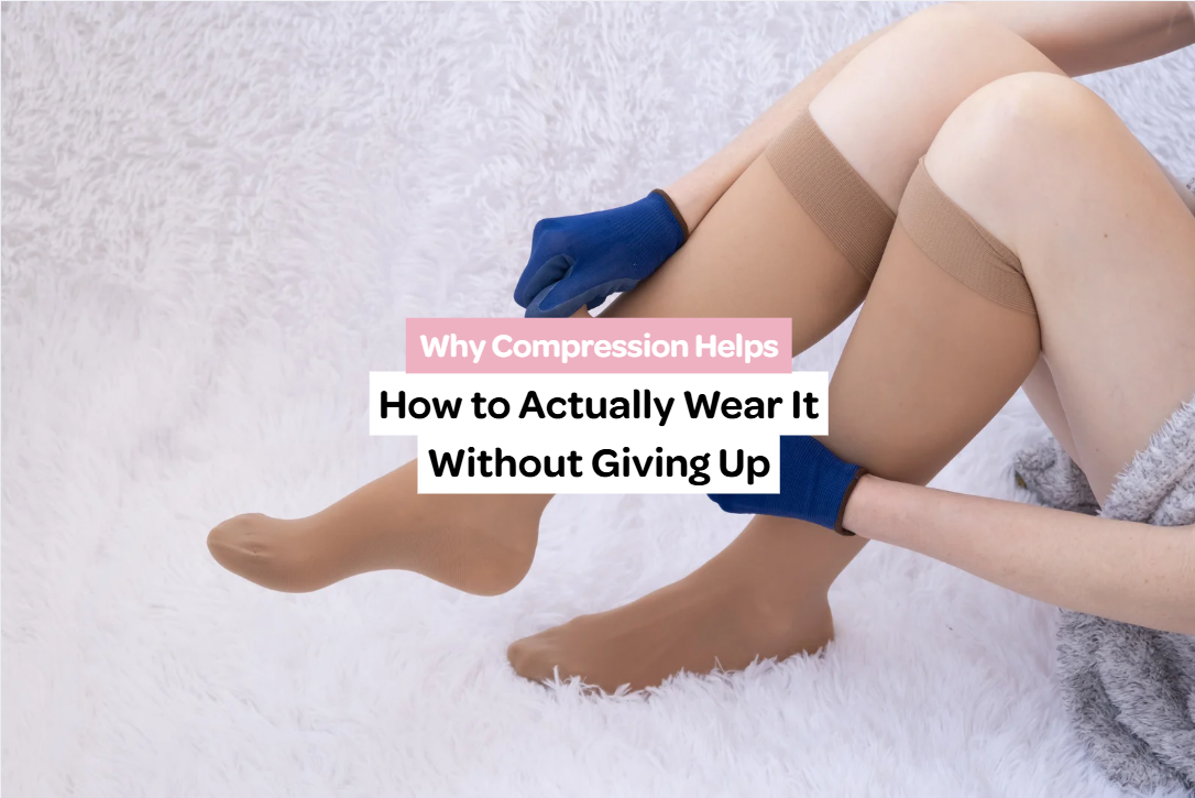 Applying compression stockings as part of lipoedema management and recovery care