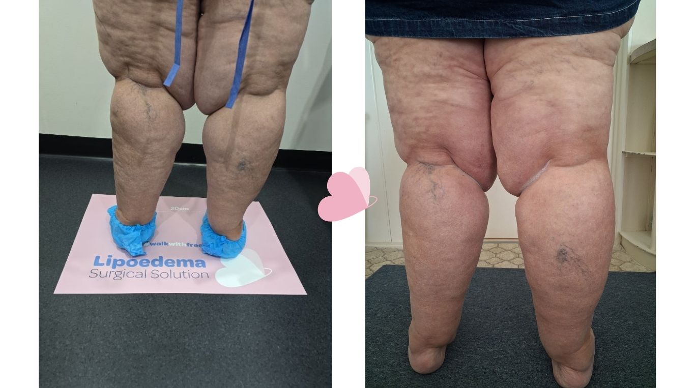 Case Study 64 - Back