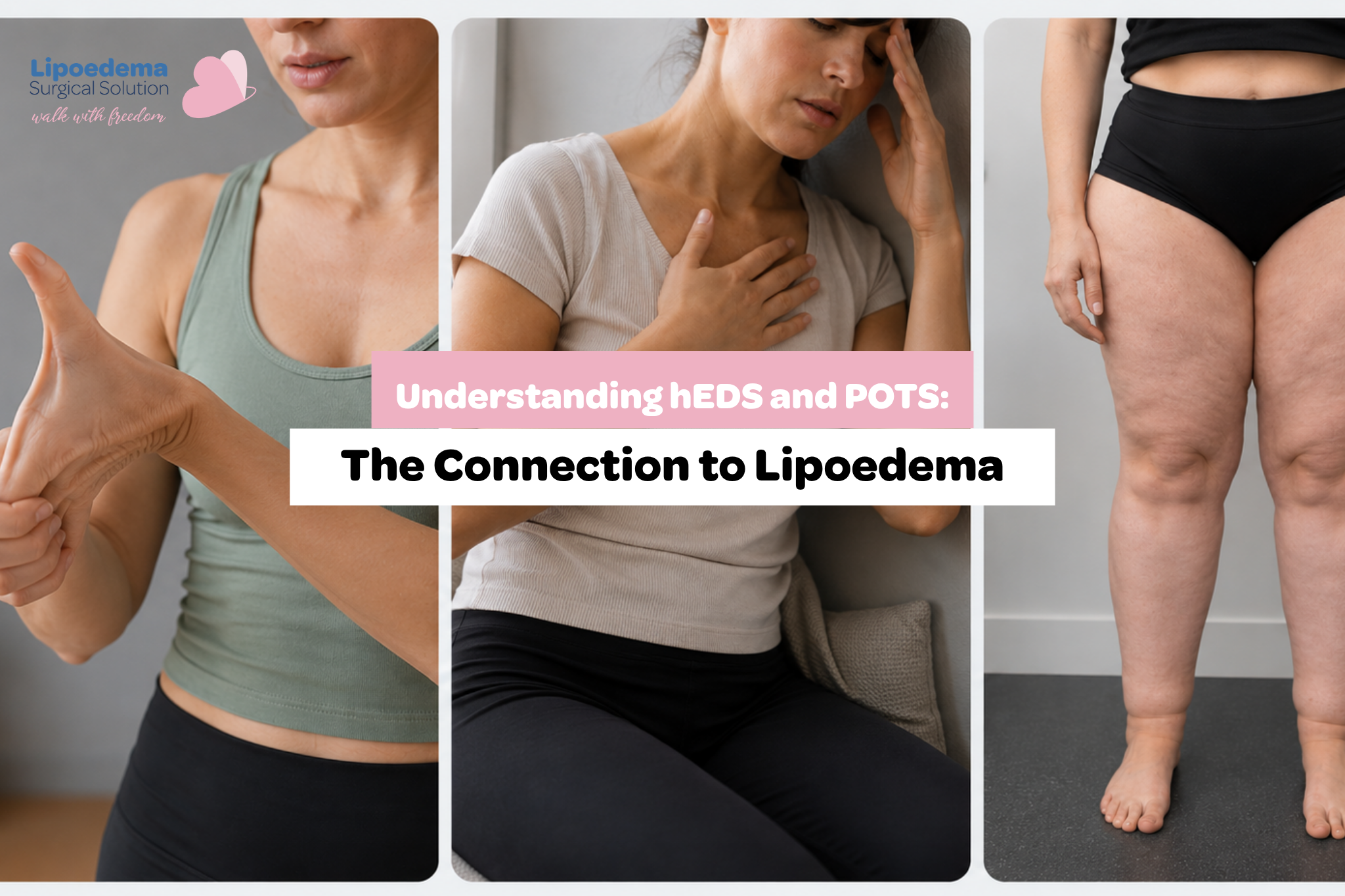 hEDS, POTS & Lipoedema